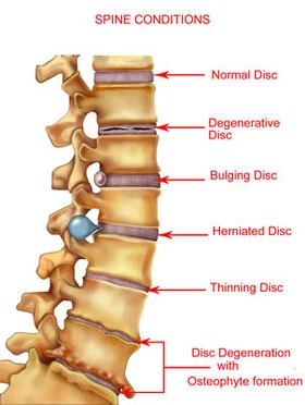 Representation of a spine with labels.