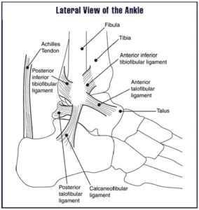 Ankle Sprains