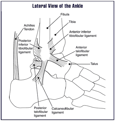 Representation of ankle sprains.