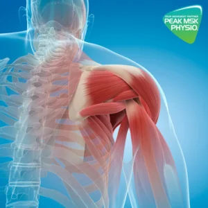 Frozen Shoulder Recovery: Moving Forward, Not Backwards