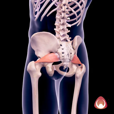 Piriformis syndrome on back pain