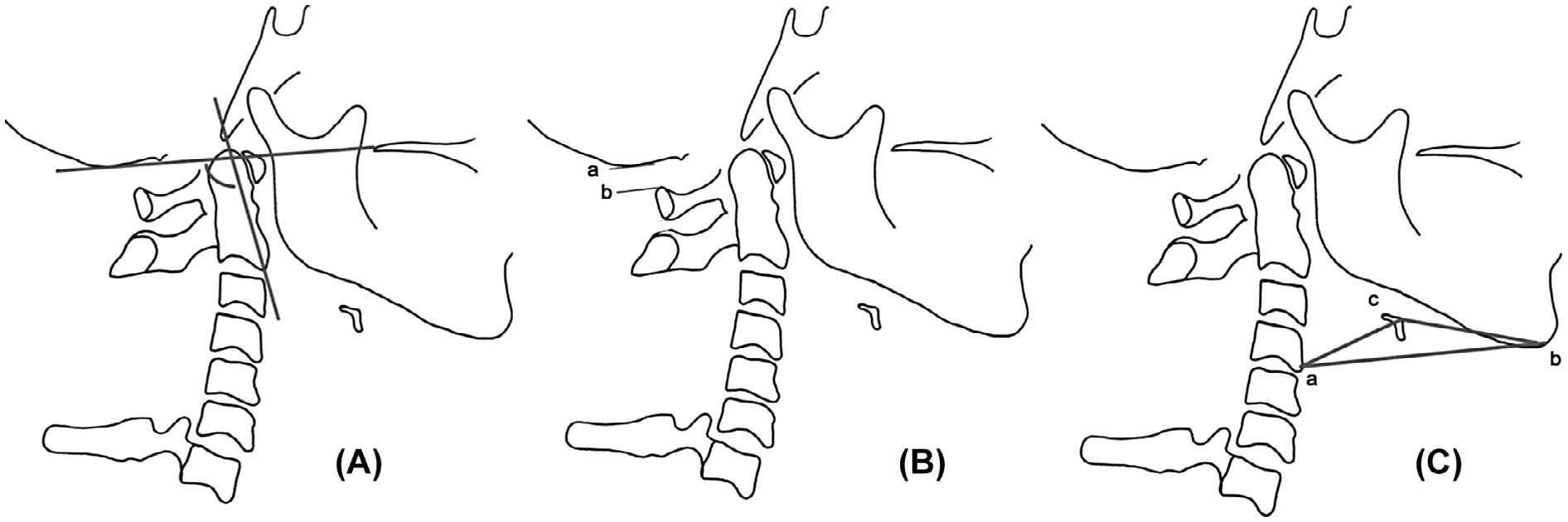 Temporomandibular