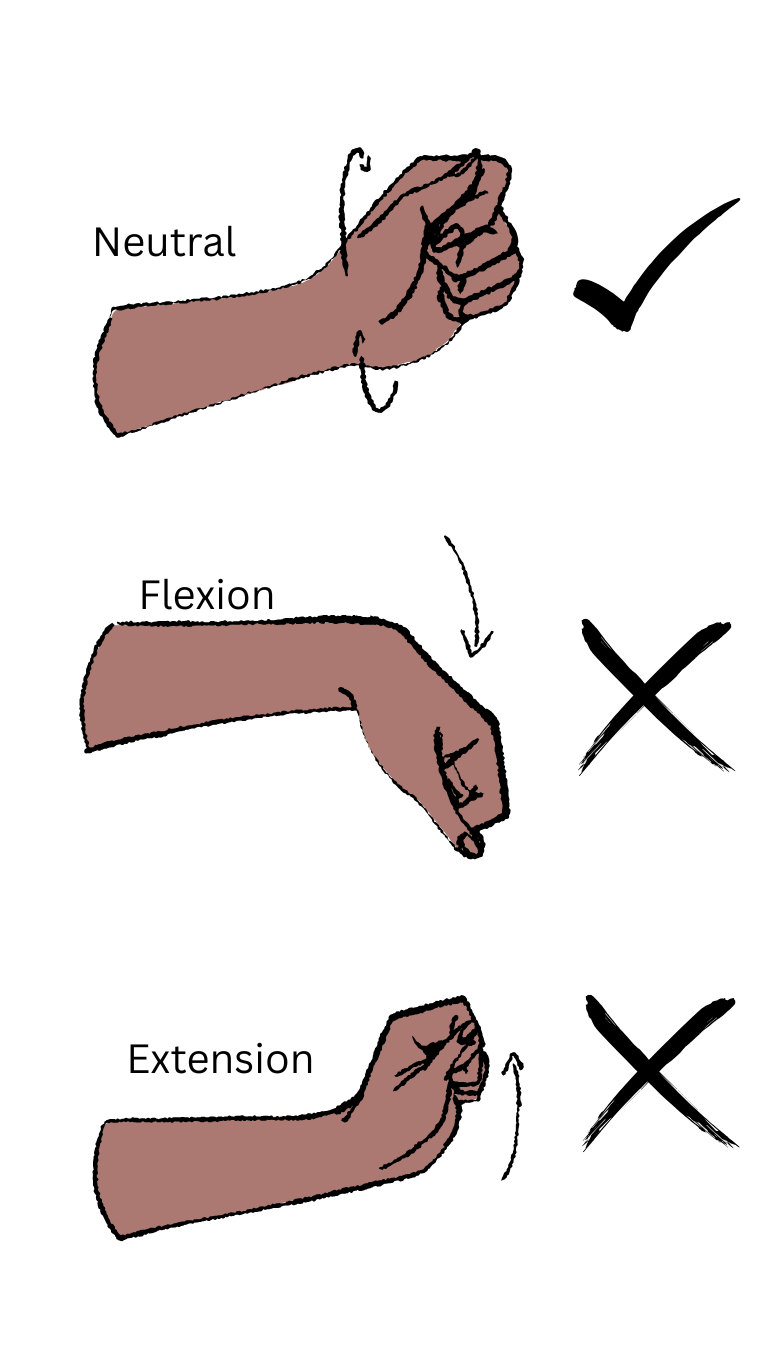 carpal tunnel management